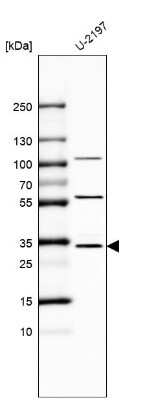 Western Blot: Monoglyceride Lipase Antibody [NBP1-89645] - Analysis in human cell line U-2197.