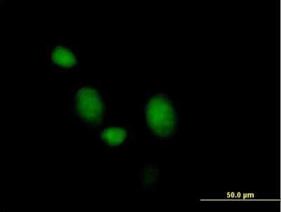 Immunocytochemistry/Immunofluorescence: Morg1 Antibody [H00084292-B01P] - Analysis of purified antibody to MORG1 on HeLa cell. (antibody concentration 10 ug/ml)