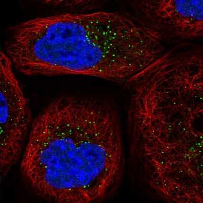 Immunocytochemistry/Immunofluorescence: Morg1 Antibody [NBP1-92132] - Immunofluorescent staining of human cell line A-431 shows localization to vesicles.