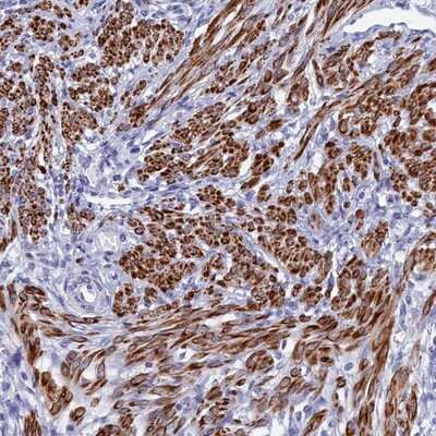 Immunohistochemistry-Paraffin: Morg1 Antibody [NBP1-92132] - Staining of human smooth muscle shows strong cytoplasmic positivity.