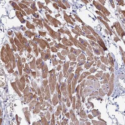 Immunohistochemistry-Paraffin: Morg1 Antibody [NBP1-92132] - Staining of human heart muscle shows moderate cytoplasmic positivity in myocytes.