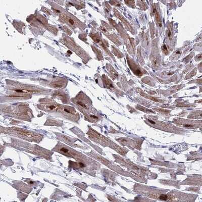 Immunohistochemistry-Paraffin: Morg1 Antibody [NBP1-92133] - Staining of human heart muscle shows cytoplasmic positivity in myocytes.