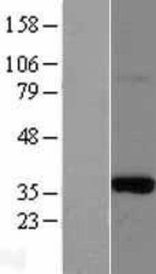 Western Blot: Morg1 Overexpression Lysate (Adult Normal) [NBL1-13185] Left-Empty vector transfected control cell lysate (HEK293 cell lysate); Right -Over-expression Lysate for Morg1.