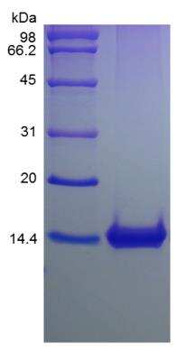 SDS-Page: Mouse CCL9/10/MIP-1 gamma Protein [NBP2-35086]