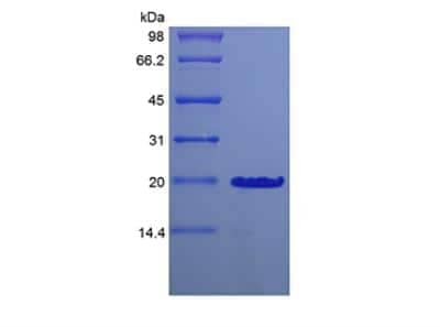 SDS-Page: Mouse Desert Hedgehog C23II Protein [NBP2-35175]