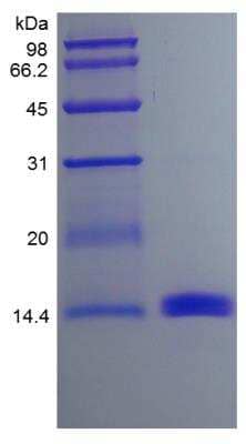 SDS-Page: Mouse GM-CSF Protein [NBP2-35066]