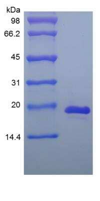 SDS-Page: Mouse IL-33 Protein [NBP2-35124]