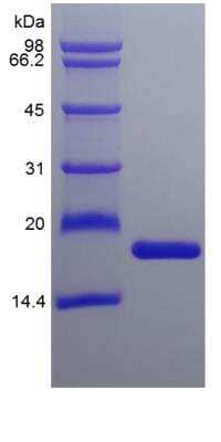 SDS-Page: Mouse IL-36 alpha/IL-1F6 160 a.a Protein [NBP2-35128]