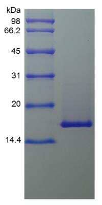 SDS-Page: Mouse IL-36 beta/IL-1F8 153 a.a Protein [NBP2-35129]