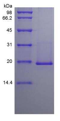 SDS-Page: Mouse IL-36 beta/IL-1F8 183 a.a Protein [NBP2-35130]