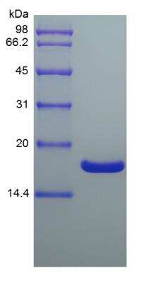 SDS-Page: Mouse IL-36 gamma/IL-1F9 152 a.a Protein [NBP2-41388]