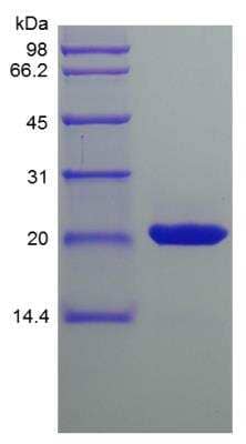 SDS-Page: Mouse Sonic Hedgehog/Shh Protein [NBP2-35174]