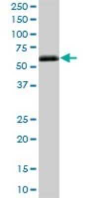 Western Blot: Mouse anti-Human Ig gamma-4 Chain C Region Secondary Antibody [H00003503-B01P] - Analysis of IGHG4 expression in human spleen.