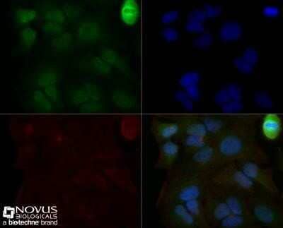 Immunocytochemistry/Immunofluorescence: Mre11 Antibody (15B8.1E7.6) - Azide and BSA Free [NBP2-80856] - HeLa cells were fixed for 10 minutes using 10% formalin and then permeabilized for 5 minutes using 1X TBS + 0.5% Triton-X100. The cells were incubated with anti-Mre11 (15B8.1E7.6) at 2 ug/ml overnight at 4C and detected with an anti-Armenian hamster IgG Dylight 488 (Green) at a 1:500 dilution. Actin was detected with Phalloidin 568 (Red) at a 1:200 dilution. Nuclei were counterstained with DAPI (Blue). Cells were imaged using a 40X objective. Image from the standard format of this antibody.