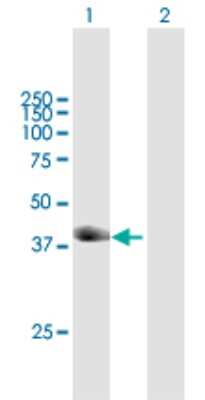 Western Blot: MuRF1/TRIM63 Antibody [H00084676-B01P] - Analysis of TRIM63 expression in transfected 293T cell line by TRIM63 polyclonal antibody.  Lane 1: TRIM63 transfected lysate(38.83 KDa). Lane 2: Non-transfected lysate.