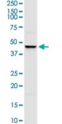 Western Blot: MuRF1/TRIM63 Antibody [H00084676-D01P] - Analysis of TRIM63 expression in MCF-7.
