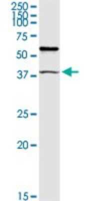 Western Blot: MuRF1/TRIM63 Antibody [H00084676-D01P] - Analysis of TRIM63 expression in human stomach.
