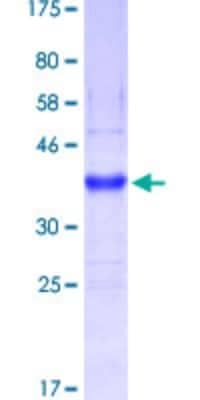 SDS-Page: Mucin 5B Partial Protein [H00727897-Q01] - 12.5% SDS-PAGE Stained with Coomassie Blue.