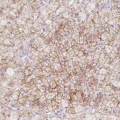 Immunohistochemistry: Mucolipin 3 Antibody [NBP2-38951] - Staining of human adrenal gland shows high expression.