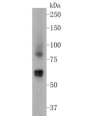 Western Blot: Mucolipin 3 Antibody [NBP2-80438] - Analysis of Mucolipin 3 on 293 cell lysate. Proteins were transferred to a PVDF membrane and blocked with 5% BSA in PBS for 1 hour at room temperature. The primary antibody (NBP2-80438, 1/500) was used in 5% BSA at room temperature for 2 hours. Goat Anti-Rabbit IgG - HRP Secondary Antibody at 1:5,000 dilution was used for 1 hour at room temperature.