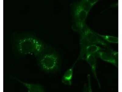 Immunocytochemistry/Immunofluorescence: Murine Hepatitis Virus A59 nsp9 Antibody (2C6.H1) [NBP2-21671] - 6-h post infection in mouse L cells. Cells were fixed in 3% para-formaldehyde. For detection Cy2 conjugated Goat-anti-Mouse IgG MX10 was used.