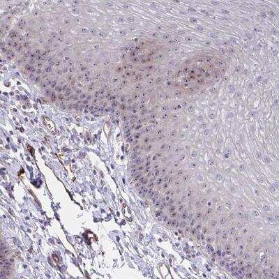 Immunohistochemistry-Paraffin: Mus81 Antibody [NBP2-32474] - Staining of human esophagus shows moderate nucleolar positivity in squamous epithelial cells.