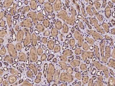 Immunohistochemistry-Paraffin: Mus81 Antibody [NBP2-97261] - Immunochemical staining of human Mus81 in human kidney with rabbit polyclonal antibody at 1:100 dilution, formalin-fixed paraffin embedded sections.