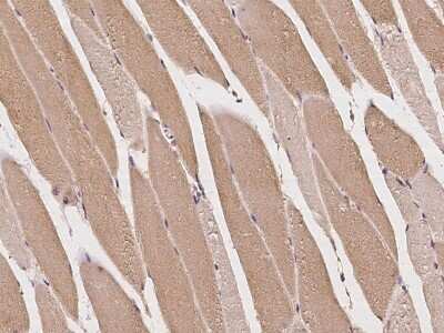 Immunohistochemistry-Paraffin: Mus81 Antibody [NBP2-97261] - Immunochemical staining of human Mus81 in human skeletal muscle with rabbit polyclonal antibody at 1:100 dilution, formalin-fixed paraffin embedded sections.