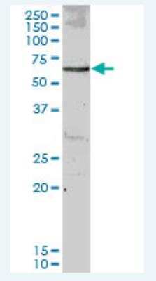 Western Blot: Mus81 Antibody [H00080198-B01P-50ug] -  Analysis of MUS81 expression in human liver.