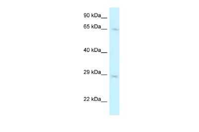 Western Blot: Mus81 Antibody [NBP2-87860] - WB Suggested Anti-MUS81 Antibody. Titration: 1.0 ug/ml. Positive Control: A549 Whole Cell