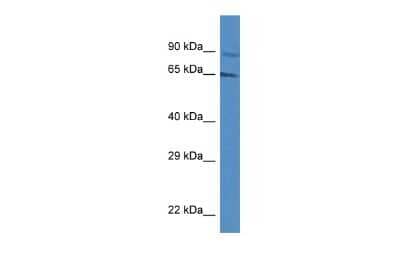 Western Blot: Mus81 Antibody [NBP2-87861] - WB Suggested Anti-MUS81 Antibody. Titration: 1.0 ug/ml. Positive Control: Jurkat Whole CellMUS81 is supported by BioGPS gene expression data to be expressed in Jurkat