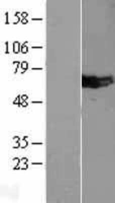 Western Blot: Mus81 Overexpression Lysate (Adult Normal) [NBL1-13396] Left-Empty vector transfected control cell lysate (HEK293 cell lysate); Right -Over-expression Lysate for Mus81.