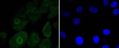Immunocytochemistry/Immunofluorescence: Musashi-1 Antibody (SJ201) [NBP2-67418] - Staining Musashi 1 in A549 cells (green). The nuclear counter stain is DAPI (blue). Cells were fixed in paraformaldehyde, permeabilised with 0.25% Triton X100/PBS.