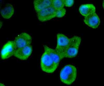 Immunocytochemistry/Immunofluorescence: Musashi-1 Antibody (SJ201) [NBP2-67418] - Staining Musashi 1 in Hela cells (green). The nuclear counter stain is DAPI (blue). Cells were fixed in paraformaldehyde, permeabilised with 0.25% Triton X100/PBS.