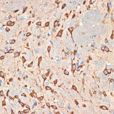 Immunohistochemistry-Paraffin: Musashi-2 Antibody (7L4E9) [NBP3-15935] - Immunohistochemistry of paraffin-embedded rat brain using Musashi-2 (Musashi-2) Rabbit mAb (NBP3-15935) at dilution of 1:100 (40x lens).Perform microwave antigen retrieval with 10 mM Tris/EDTA buffer pH 9.0 before commencing with IHC staining protocol.