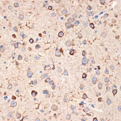 Immunohistochemistry-Paraffin: Musashi-2 Antibody (7L4E9) [NBP3-15935] - Immunohistochemistry of paraffin-embedded mouse brain using Musashi-2 (Musashi-2) Rabbit mAb (NBP3-15935) at dilution of 1:100 (40x lens).Perform microwave antigen retrieval with 10 mM Tris/EDTA buffer pH 9.0 before commencing with IHC staining protocol.