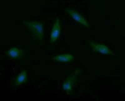 Immunocytochemistry/Immunofluorescence: Musashi-2 Antibody (OTI2F10) - Azide and BSA Free [NBP2-72836] - Analysis of HeLa cells.
