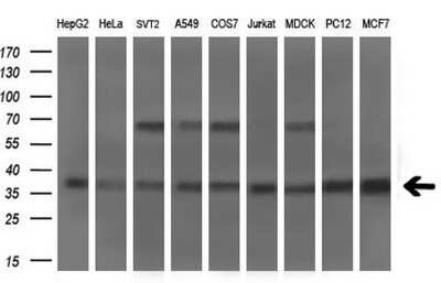 Western Blot: Musashi-2 Antibody (OTI2F10) - Azide and BSA Free [NBP2-72836] - Analysis of extracts (35ug) from 9 different cell lines by using MSI2 monoclonal antibody (HepG2: human; HeLa: human; SVT2: mouse; A549: human; COS7: monkey; Jurkat: human; MDCK: canine; PC12: rat; MCF7: human).(1:200)