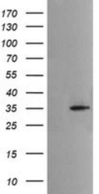 Western Blot: Musashi-2 Antibody (OTI2F10) - Azide and BSA Free [NBP2-72836] - Analysis of HEK293T cells were transfected with the pCMV6-ENTRY control (Left lane) or pCMV6-ENTRY MSI2 .