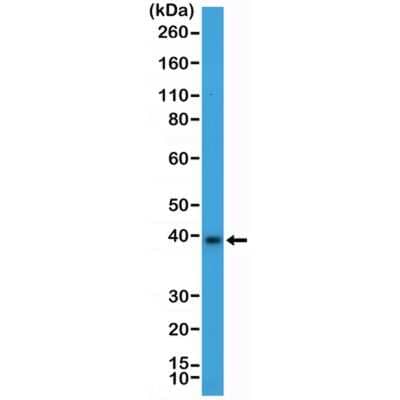 Western Blot: Musashi-2 Antibody (RM422) [NBP3-09175] - Western Blot of mouse brain tissue lysate using NBP3-09175 at a 1:2000 dilution.