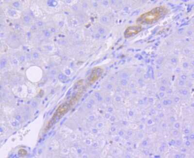 Immunohistochemistry-Paraffin: Musashi-2 Antibody (ST59-02) [NBP2-67547] - Analysis of paraffin-embedded human liver tissue using anti-MSI2 antibody. Counter stained with hematoxylin.