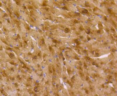 Immunohistochemistry-Paraffin: Musashi-2 Antibody (ST59-02) [NBP2-67547] - Analysis of paraffin-embedded mouse heart tissue using anti-MSI2 antibody. Counter stained with hematoxylin.