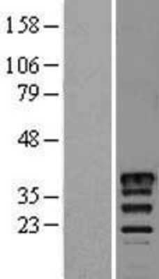 Western Blot: Musashi 2 Overexpression Lysate (Adult Normal) [NBL1-13329] Left-Empty vector transfected control cell lysate (HEK293 cell lysate); Right -Over-expression Lysate for Musashi 2.