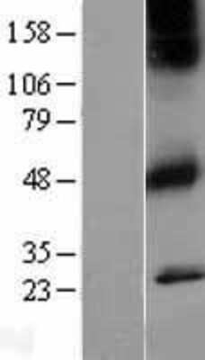 Western Blot: Muscarinic Acetylcholine Receptor 1 Overexpression Lysate (Adult Normal) [NBL1-09173] Left-Empty vector transfected control cell lysate (HEK293 cell lysate); Right -Over-expression Lysate for Muscarinic Acetylcholine Receptor 1.