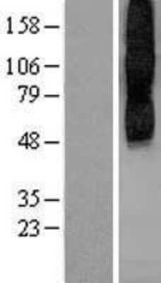 Western Blot: Muscarinic Acetylcholine Receptor 2 Overexpression Lysate (Adult Normal) [NBP2-08823] Left-Empty vector transfected control cell lysate (HEK293 cell lysate); Right -Over-expression Lysate for Muscarinic Acetylcholine Receptor 2.