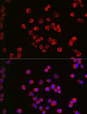 Immunocytochemistry/Immunofluorescence: Muscarinic Acetylcholine Receptor M1/CHRM1 Antibody [NBP2-94511] - Analysis of Neuro-2a cells using CHRM1 Rabbit pAb at dilution of 1:200 (40x lens). Blue: DAPI for nuclear staining.