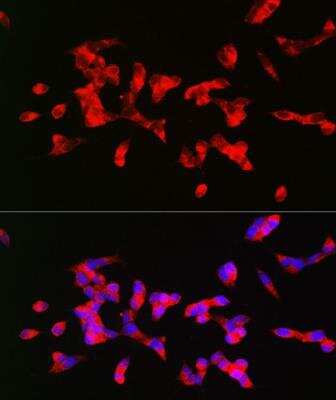 Immunocytochemistry/Immunofluorescence: Muscarinic Acetylcholine Receptor M1/CHRM1 Antibody [NBP2-94511] - Analysis of SH-SY5Y cells using CHRM1 Rabbit pAb at dilution of 1:200 (40x lens). Blue: DAPI for nuclear staining