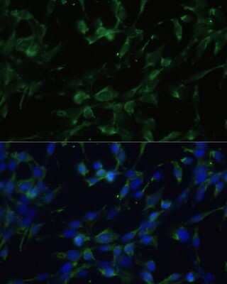 Immunocytochemistry/Immunofluorescence: Muscarinic Acetylcholine Receptor M1/CHRM1 Antibody [NBP2-94811] - Analysis of NIH-3T3 cells using Muscarinic Acetylcholine Receptor M1/CHRM1 at dilution of 1:100. Blue: DAPI for nuclear staining.