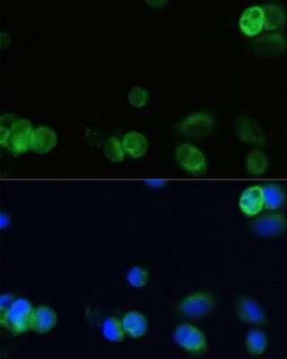 Immunocytochemistry/Immunofluorescence: Muscarinic Acetylcholine Receptor M1/CHRM1 Antibody [NBP2-94811] - Analysis of OVCAR-3 cells using Muscarinic Acetylcholine Receptor M1/CHRM1 at dilution of 1:100. Blue: DAPI for nuclear staining.