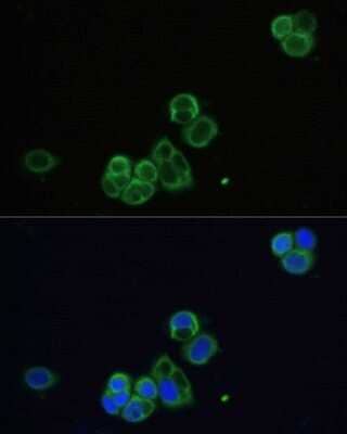 Immunocytochemistry/Immunofluorescence: Muscarinic Acetylcholine Receptor M1/CHRM1 Antibody [NBP2-94811] - Analysis of OVCAR-3 cells using Muscarinic Acetylcholine Receptor M1/CHRM1 at dilution of 1:100. Blue: DAPI for nuclear staining.